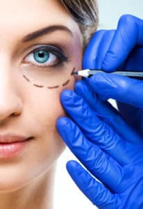 Blepharoplasty greenfield | Longwood Eye & LASIK Center