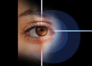 cataract treatment in greenfield ma