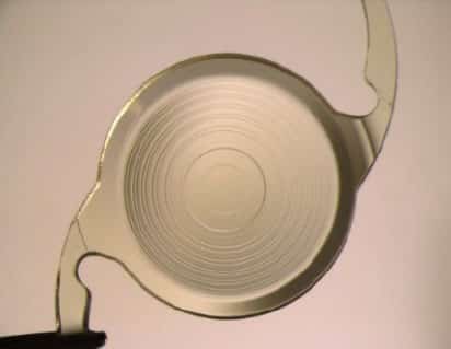 Tecnis Intraocular lens for cataracts