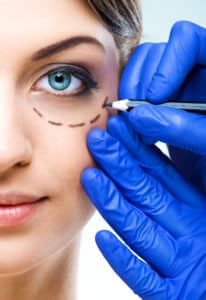 Blepharoplasty greenfield | Longwood Eye & LASIK