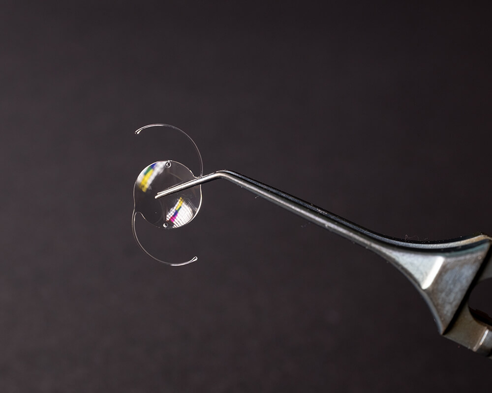 intraocular lens for cataracts