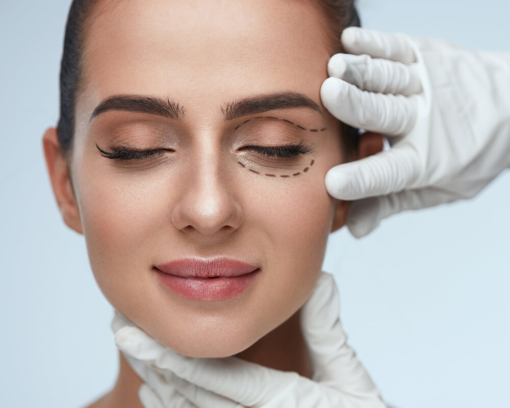 Woman being prepped for oculoplastic procedure
